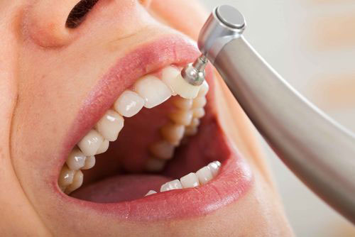 The image shows a person with an open mouth, receiving dental care using a device that appears to be a dental drill or similar tool.